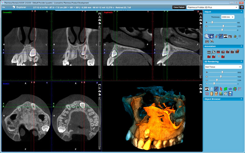 orthodontie 3D